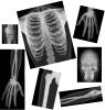 /trait100932/questt120639/critiquet1206395 and up - Toys products - True-to-Life Human X-Rays - Package of 18